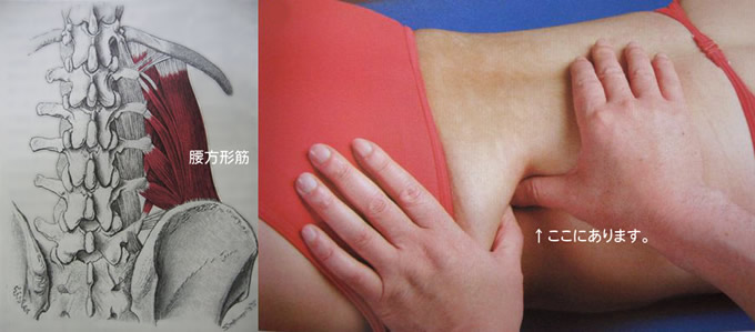 腰方形筋痛はどのように診断されますか?
