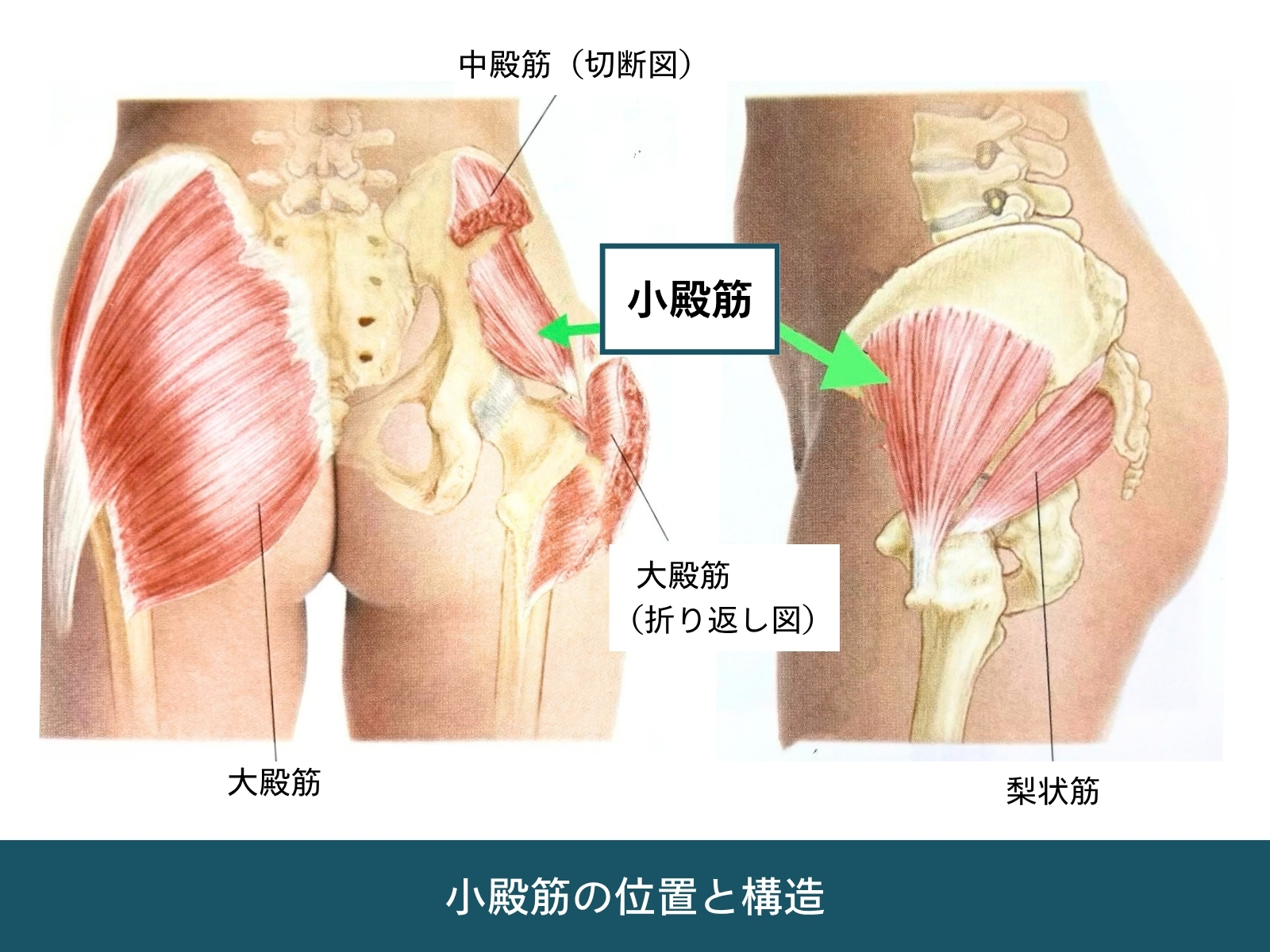骨盤の深層にある小殿筋の位置を示す解剖図。大殿筋・中殿筋の奥にある小殿筋を赤色で強調したイラスト
